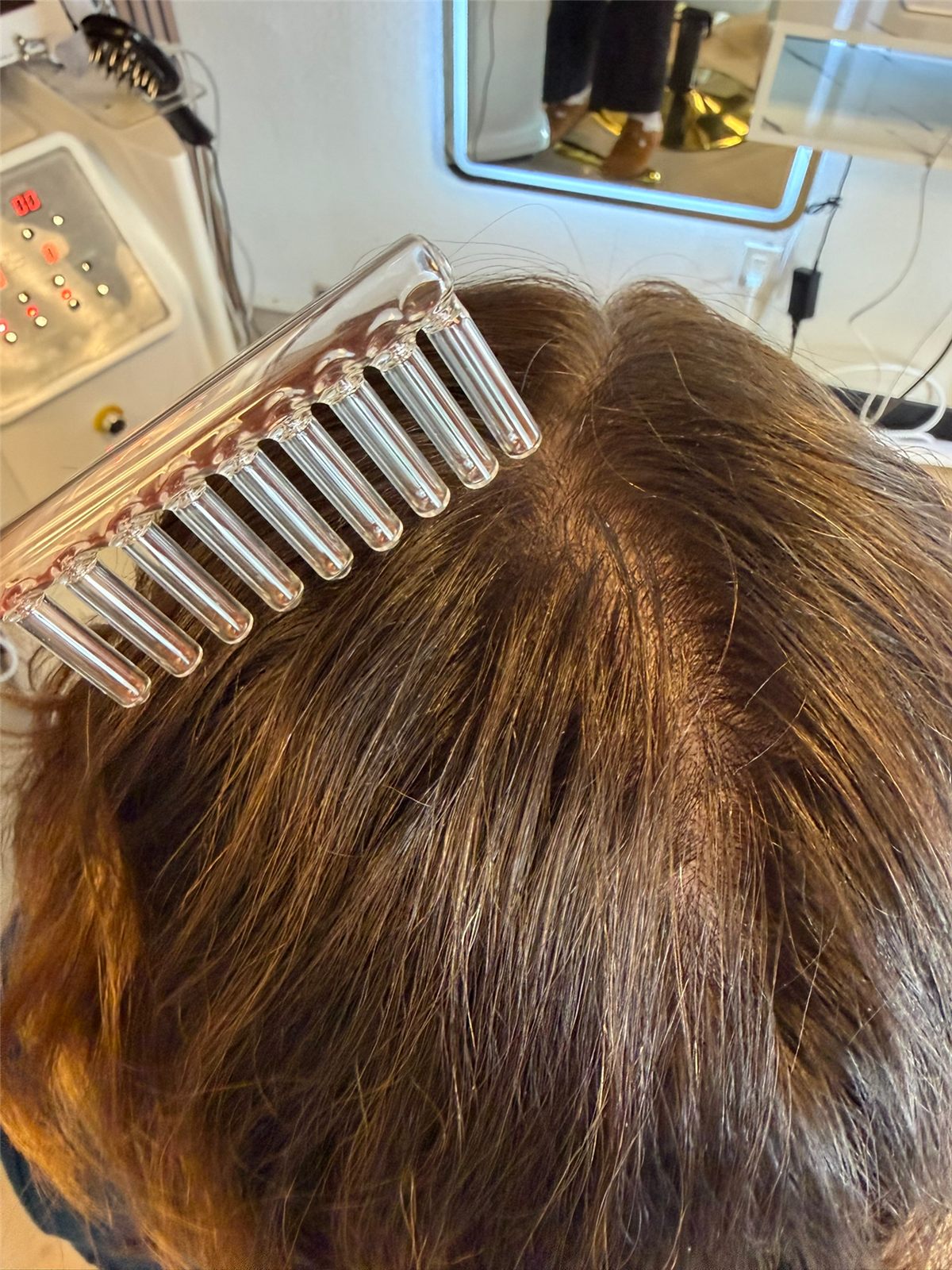 Scalp before treatment